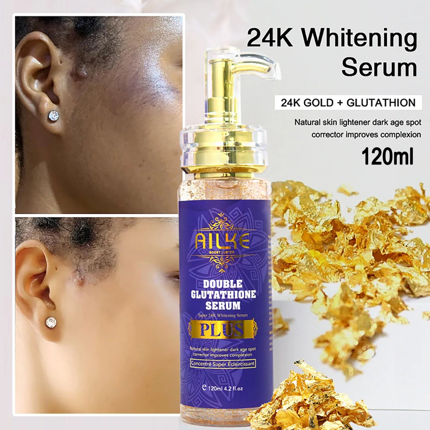 AILKE Body Cream For Whitening and Clearing Uneven Skin Tone, Moisturizes, Removes Dark Spots, Support Private label, OEM