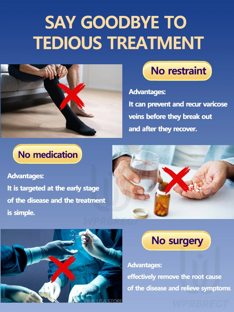2nd generation varicose vein laser eliminates vasculitis and phlebitis, relieves spider leg pain, laser pointer for treatment