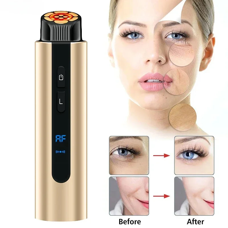 Microcurrent Face Lifting Machine Beauty Products High Frequency Skin Care Massager for Facial Lifting and Eyes Tightening care