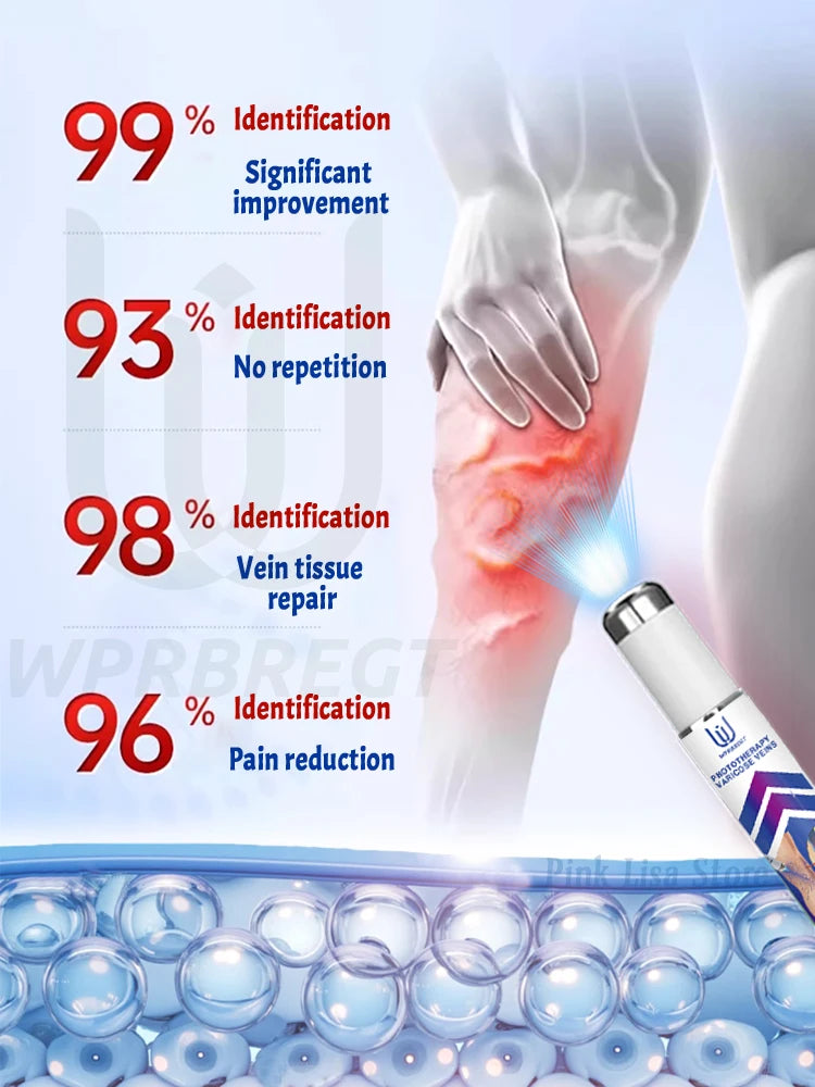 2nd generation varicose vein laser eliminates vasculitis and phlebitis, relieves spider leg pain, laser pointer for treatment