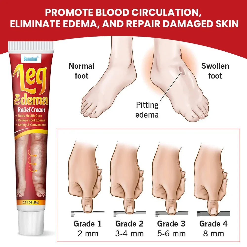 20g Leg Relief Cream for Circulation Relieve Foot Edema Massage Cream for Swollen Legs and Ankles Body Health Care
